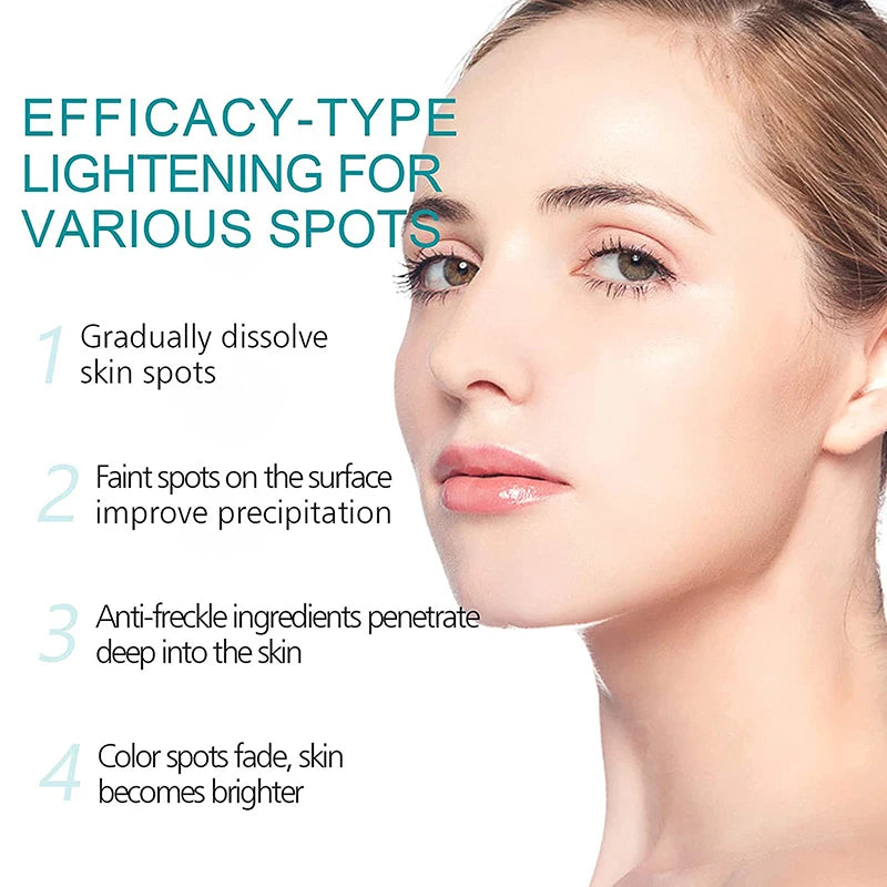 Crème correctrice de taches de rousseur pour le visage, élimine les points noirs, mélasma, Anti-taches brunes, éclaircit la Pigmentation, hydrate, soins de la peau, cosmétiques