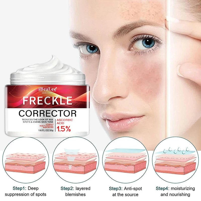 Crème correctrice de taches de rousseur pour le visage, élimine les points noirs, mélasma, Anti-taches brunes, éclaircit la Pigmentation, hydrate, soins de la peau, cosmétiques
