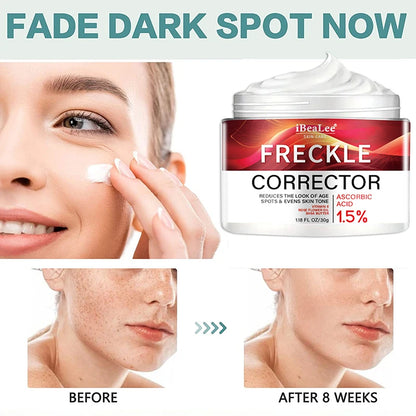 Crème correctrice de taches de rousseur pour le visage, élimine les points noirs, mélasma, Anti-taches brunes, éclaircit la Pigmentation, hydrate, soins de la peau, cosmétiques