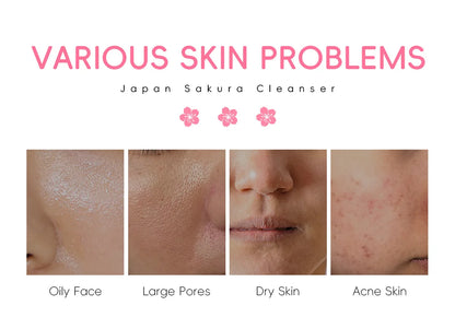 LAIKOU Sakura nettoyant pour le visage mousse lavage du visage supprimer points noirs hydratant rétrécit les Pores nettoyage en profondeur contrôle de l'huile soins de la peau 50g