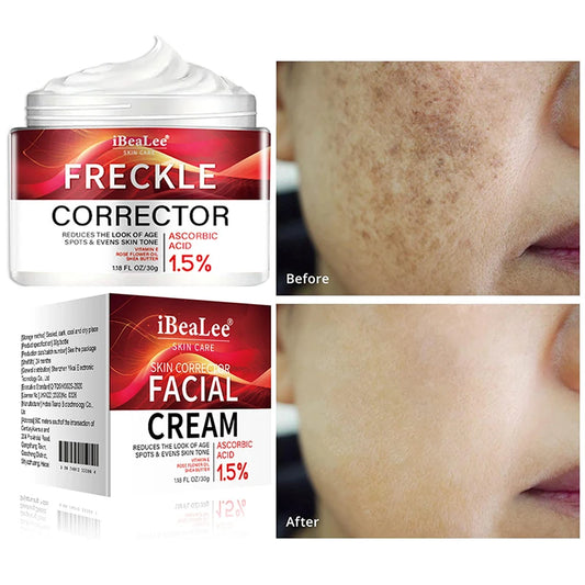 Crème correctrice de taches de rousseur pour le visage, élimine les points noirs, mélasma, Anti-taches brunes, éclaircit la Pigmentation, hydrate, soins de la peau, cosmétiques