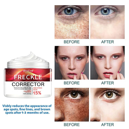 Crème correctrice de taches de rousseur pour le visage, élimine les points noirs, mélasma, Anti-taches brunes, éclaircit la Pigmentation, hydrate, soins de la peau, cosmétiques
